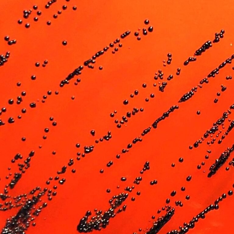 Typisch schwarze Kolonien von Diphtheriebakterien (Corynebacterium diphtheriae), kultiviert am Institut für Medizinische Mikrobiologie auf einem speziellen Nährmedium in einer Petrischale. | Quelle: Farah Fiechter und Frank Imkamp | Copyright: Universität Zürich