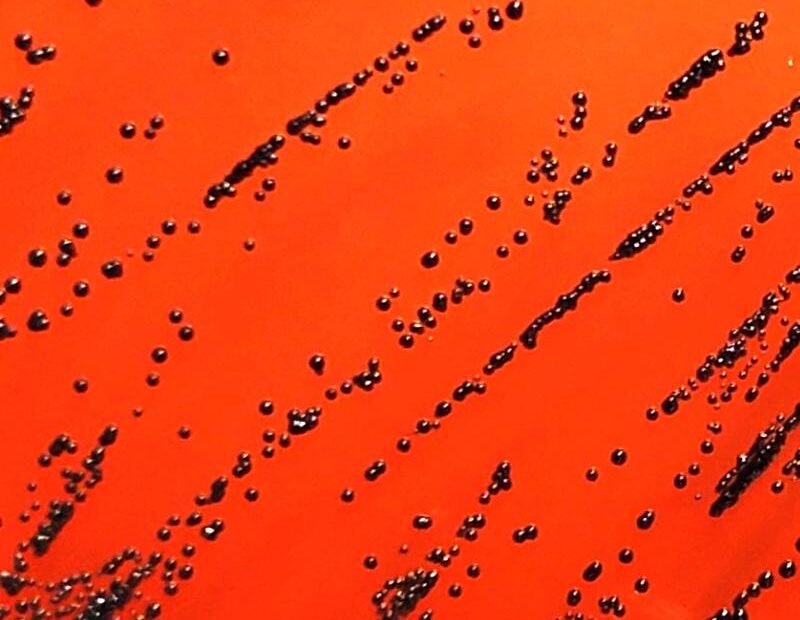 Typisch schwarze Kolonien von Diphtheriebakterien (Corynebacterium diphtheriae), kultiviert am Institut für Medizinische Mikrobiologie auf einem speziellen Nährmedium in einer Petrischale. | Quelle: Farah Fiechter und Frank Imkamp | Copyright: Universität Zürich