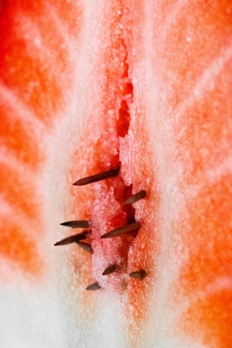 Ausstellung in Dortmund widmet sich der unbekannten Krankheit Vulvodynie