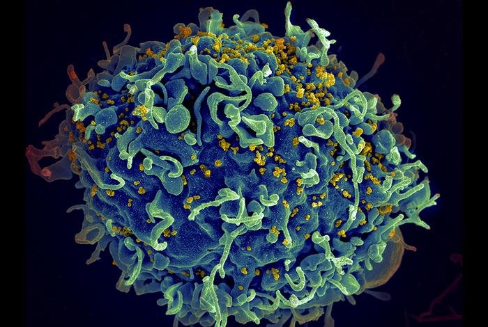 HIV-Partikel (winzige gelbe Kugeln) greifen eine blau dargestellte CD4+ T-Zelle an. Das Virus greift bevorzugt T-Zellen an, die eine entscheidende Rolle bei der Immunreaktion des Körpers gegen Eindringlinge wie Bakterien und Viren spielen. Credits: Seth Pincus, Elizabeth Fischer und Austin Athman, National Institute of Allergy and Infectious Diseases, National Institutes of Health