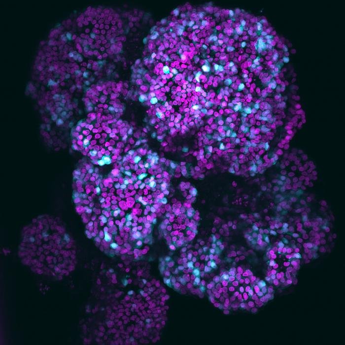 Mikroskopische Aufnahme des Organoids der Bauchspeicheldrüse. Das Magenta zeigt die Zellkerne, und das Cyan hebt die Azinuszellen hervor, die Verdauungsenzyme absondern. Kredit Amanda Andersson Rolf und Kelvin Groot