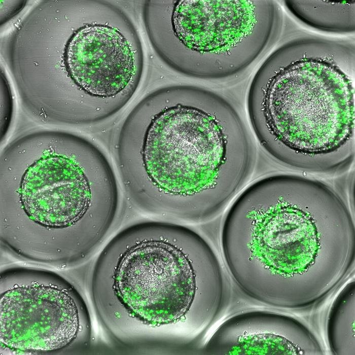 Neue Organoid-Plattform für die menschliche Leber bietet Durchbruch bei der Vorhersage immunvermittelter Arzneimitteltoxizität