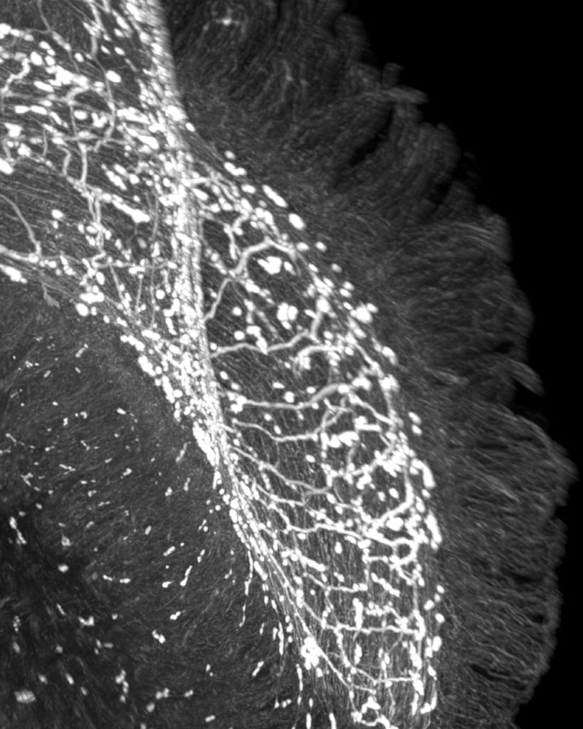 Neuronen in der Darmwand, die VIP produzieren, ein Neuropeptid, das zur Regulierung von Immunreaktionen beiträgt. Credits: Fundação D. Anna de Sommer Champalimaud e Dr. Carlos Montez Champalimaud