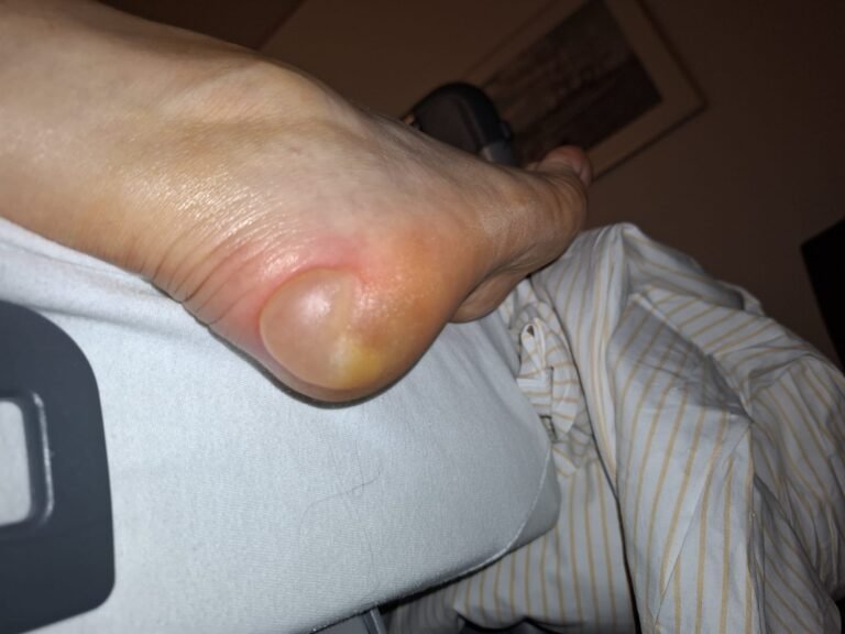 Skandal in der Helios Endo-Klinik Hamburg: Patienten nach Operationen bis zu 60 Stunden ohne ärztliche Visite