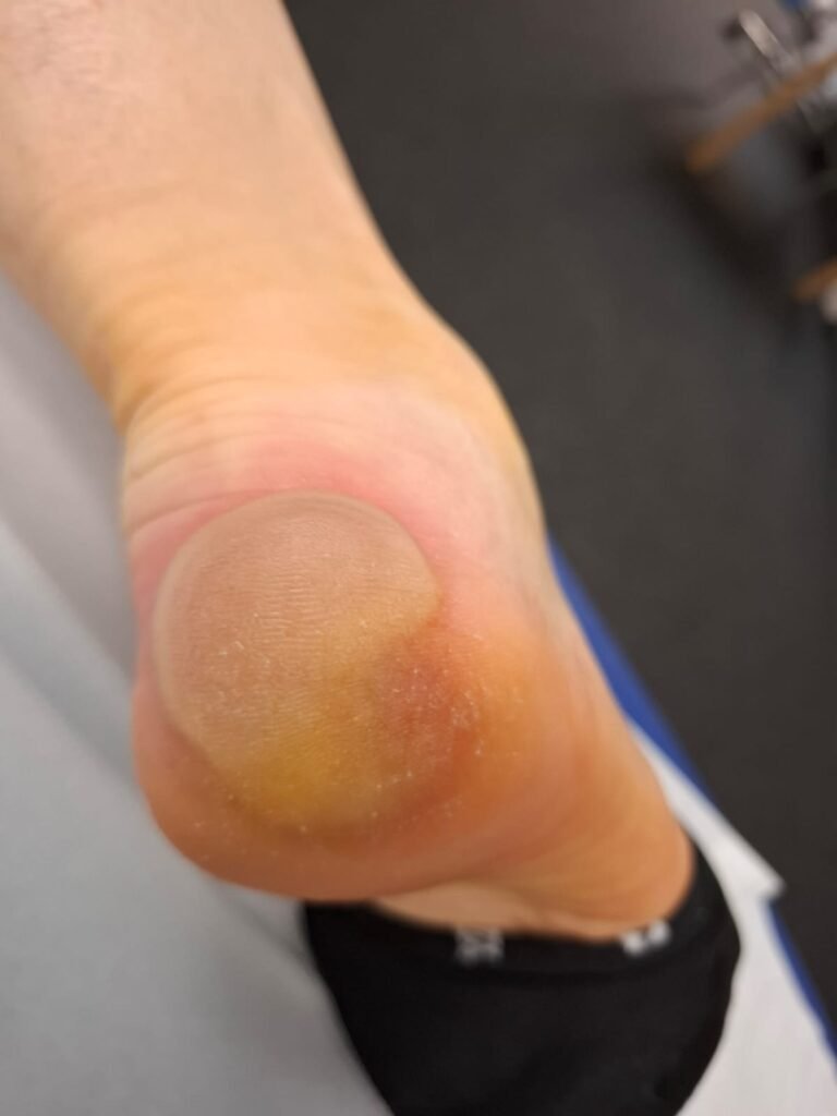 Minus-Patienten in privaten Kliniken: Vorzeitige Entlassungen gefährden Versorgung – Helios-Kliniken im Fokus