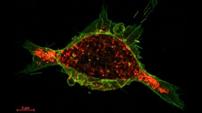 40 Sekunden nach der Verabreichung haben sich das Kalzium-regulierte Proteinmedikament (grün) und die Tumorzellrezeptoren (rot) verbunden, und die Internalisierung ist im Gange.Credits
KTH Royal Institute of Technology