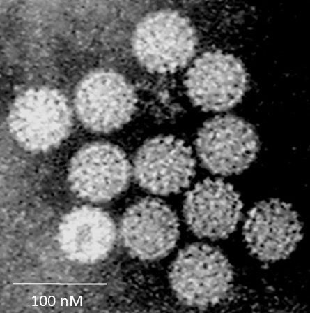 HPV-Virus. Credits: Dr Graham Beards • CC BY-SA 4.0