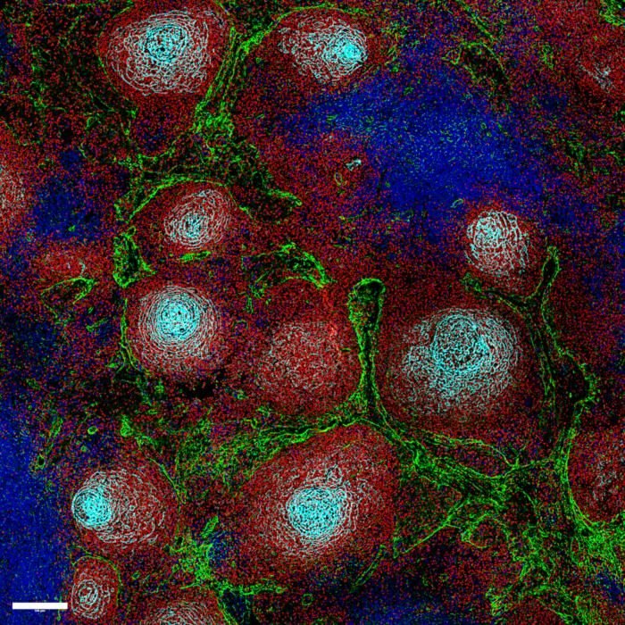 Chaos in Lymphknoten fördert Krebswachstum bei aggressiven Lymphomen